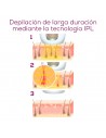 Depiladora IPL - Beurer IPL-5800
